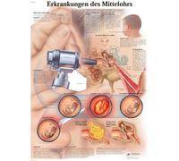 3B Scientific VR0252UU - Póster explicativo sobre afecciones oculares (en alemán)