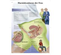 3B Scientific VR0542UU - Póster explicativo sobre la incontinencia urinaria femenina (en alemán)