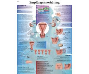 3B Scientific VR0591UU - Póster explicativo sobre métodos anticonceptivos (en alemán)