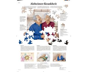 3B Scientific VR0628UU - Póster explicativo sobre la enfermedad de Alzheimer (en alemán)