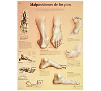 3B Scientific VR2185L - Tabla de alergias de papel laminado brillante resistente a los rayos UV (tabla anatómica de las deformidades de los pies, francés), tamaño del póster 50,8 cm de ancho x 66 cm de alto