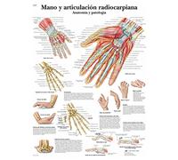 3B Scientific VR3171UU Impreso en Papel, Mano y Articulación Radiocarpiana, Anatomía y Patología