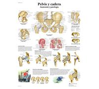 3B Scientific VR3172L Impreso En Papel, Pelvis y Cadera, Anatomía y Patología