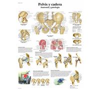 3B Scientific VR3172UU Impreso En Papel, Pelvis y Cadera, Anatomía y Patología