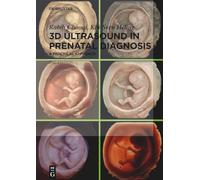 3D Ultrasound in Prenatal Diagnosis: A Practical Approach