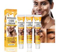 3pcs Crema De Cuidado De Vitiligo Para La Piel Vitiligo,Crema De Vitiligo,Elimina Las Manchas Blancas,Cremas Para El Cuidado Del Vitiligo,Mejora La Pigmentación Reguladora De La Crema De Vitiligo