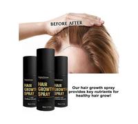 3x Hair Growth Spray with Biotin & Caffeine - Fast-Acting Hair Regrowth Treatment for Thinning Hair in Men & Women