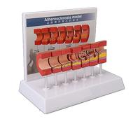 7PCS Modelo de anatomía de la arteria Modelo de arteria del cuerpo humano Modelos de anatomía educativos Modelo vascular de trombo de aterosclerosis para la escuela clínica