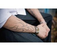 9 sesiones de láser para eliminar tatuajes con láser Neodimio Yag Q-Switched