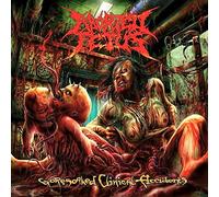 Aborted Fetus - Goresoaked Clinical Accidents