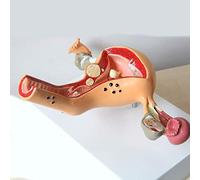 Accesorios de Modelo uterino de Ovario Ciencia Anatomía patológica Suministros transversales de la enseñanza 23x16 cm / 9.06 x 6.30in