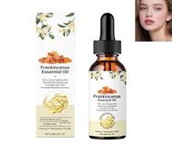 Aceite esencial de incienso de extracto de resina, crema hidratante facial y corporal para hidratación y nutrición, cuidado antienvejecimiento, cuidado del cabello, aceites esenciales aromaterapia (1