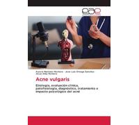 Acne vulgaris: Etiología, evaluación clínica, patofisiología, diagnóstico, tratamiento e impacto psicológico del acné