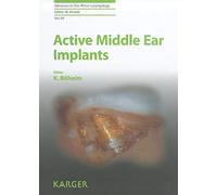 Active Middle Ear Implants: 69 (Advances in Oto-Rhino-Laryngology, 69)