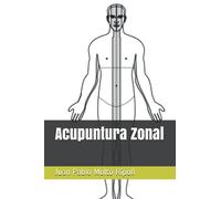 Acupuntura Zonal