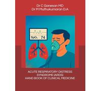 ACUTE RESPIRATORY DISTRESS SYNDROME - HAND BOOK OF CLINICAL MEDICINE