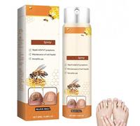 Advanced Nail Repair Spray, Nail Repair Essence Spray, Nail Soothing Sprays for Toenail,Natural Ingredients Extracts, Gentle and Effective (1 pcs)
