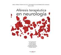 Aféresis terapéutica en neurología