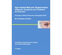 Age-related Macular Degeneration (ebook)