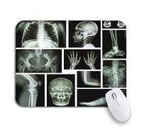 Alfombrilla De Ratón Radiografía De Múltiples Partes del Sistema Esquelético Humano Antideslizante Mouse Pad con Bordes Cosidos Alfombrilla Gaming, para Oficina, Ordenador, 25 x 30cm