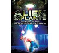 Alien Implants: Evidence of UFO Abductions & Encounters [Alemania] [DVD]