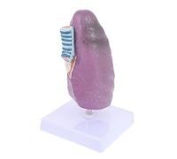 Alipis de Pulmón para Educación Médica de Pulmón Patológico para Exhibición y Demostración Respiratoria para Estudiantes y Profesionales Salud