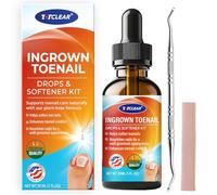 Alivio de uñas encarnadas: herramienta de uñas encarnadas para hombres y mujeres, kit de eliminación de uñas encarnadas, gotas correctoras de uñas encarnadas, removedor de uñas encarnadas, solución
