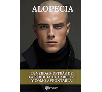 Alopecia: La Verdad Detrás de la Pérdida de Cabello y Cómo Afrontarla