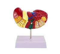 AMITD Life-Size 2-Parts Cirrhosis Liver Model, Numbered for Classroom & Research Display