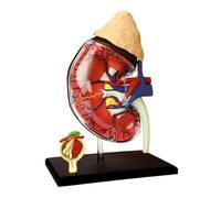 AMULONG Anatomía De La Educación Modelo De Anatomía del Riñón Humano 4d Vision Desmontable 13 Partes Humana para El Médico Científico Muñeca de Anatomía