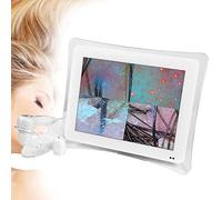 Analizador de cabello de diagnóstico de piel, escáner de piel facial LCD de 15 pulgadas, detector de cuero cabelludo con pantalla LCD, analizador de cabello digital preciso y eficiente