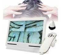 Analizador De Cabello Profesional para DiagnóStico De Piel, Detector De Cuero Cabelludo, Microscopio Capilar, Detector De Piel/FolíCulo Piloso/Cuero Cabelludo,4 Pantallas De Comparación