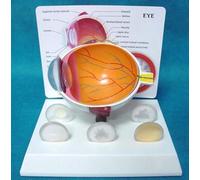 Anatomía del modelo Globo ocular humano enfermo Lesión ocular Córnea del ojo Catarata Sección transversal del modelo ocular Educación médica