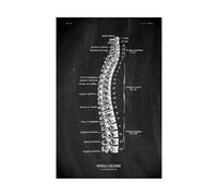 Anatomía humana Marca de arte Medical Hospital hospital Sistema órgano muscular Vintage lienzo(KK1403,30x45cm No Frame)