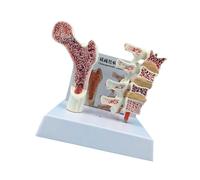 Anatomía humana Modelo de osteoporosia para enseñar exhibición osteoporosia columna vertebral vértebras esqueleto anatómico anatomía humana vértebras esqueleto anatómico para estudio