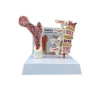 Anatomía humana, modelo de osteoporosia, vértebras educativas, esqueleto anatómico, herramienta de enseñanza para estudiar, anatomía humana, vértebras, esqueleto anatómico para estudio
