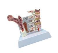 Anatomía humana modelo de osteoporosia vértebras educativas esqueleto anatómico herramienta de enseñanza para estudio vértebras esqueleto anatómico columna vertebral suministros escolares