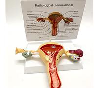anatomía, Modelo anatómico médico del útero humano, modelo y los ovarios con patologías, avanzado de simulación la estructura materno