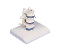 Anatomía Modelo lumbar con hernia discal, desmontable, trípode