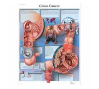 Anatomía patología anatómica el gráfico del sistema respiratorio pinturas clásicas en lienzo carteles de pared Vintage pegatinas decoración hogar regalo(4,Canvas 15x20cm)