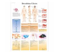 Anatomía patología anatómica el gráfico del sistema respiratorio pinturas clásicas en lienzo carteles de pared Vintage pegatinas decoración hogar regalo(2,A3 kraft Framed)