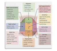 Anatomy Study Guide Poster Human Body Abdominal Regions Chart Educational Science Wall Art for Library and Nursing School(Framed,08x12inch(20x30cm))