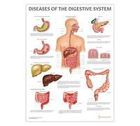 AnatomyStuff Póster de enfermedades del sistema digestivo, 45 x 60 cm, 45,7 x 60 cm, anatomía del sistema digestivo, diagrama de gastroenterología