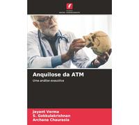 Anquilose da ATM: Uma análise exaustiva