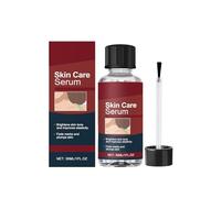 Antiverrugas Con Nitróge,Natural Eliminar Verrugas y Lunares，Tratamiento Para Verrugas Plantares Y Genitales，lunares y callosidades，Suavemente Las Verrugas Quitar Comunes