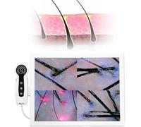 ANXYYDS Detector de Cuero cabelludo y Pelo, probador de microscopio con Pantalla LCD HD de 15 Pulgadas, folículo piloso, Aceite de Piel Facial, Humedad