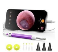 Anykit Otoscopio digital con giroscopio, cámara de visión ultra clara HD con herramientas de eliminación de cera, otoscopio de video con luz, compatible con Android, iPhone 15 (morado)