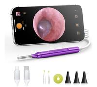AnyScope Otoscopio digital compatible con dispositivos iPhone y Android, cámara de oído HD con herramientas de eliminación de cera de oído, otoscopio de video con luz, captura fotos y videos (morado)