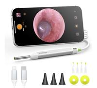 AnyScope Otoscopio digital con giroscopio, cámara de oído HD con herramientas de eliminación de cera, otoscopio de video con luz, compatible con iPhone y Android (plateado)