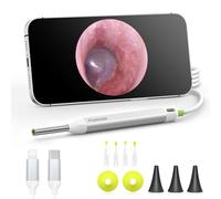 AnyScope Otoscopio digital HD, otoscopio de video con luz, cámara de visión ultra clara con herramientas de eliminación de cera, compatible con dispositivos iPhone y Android (plateado)